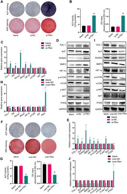 Inhibition of PTEN promotes osteointegration of titanium implants in type 2 diabetes by enhancing anti-inflammation and osteogenic capacity of adipose-derived stem cells